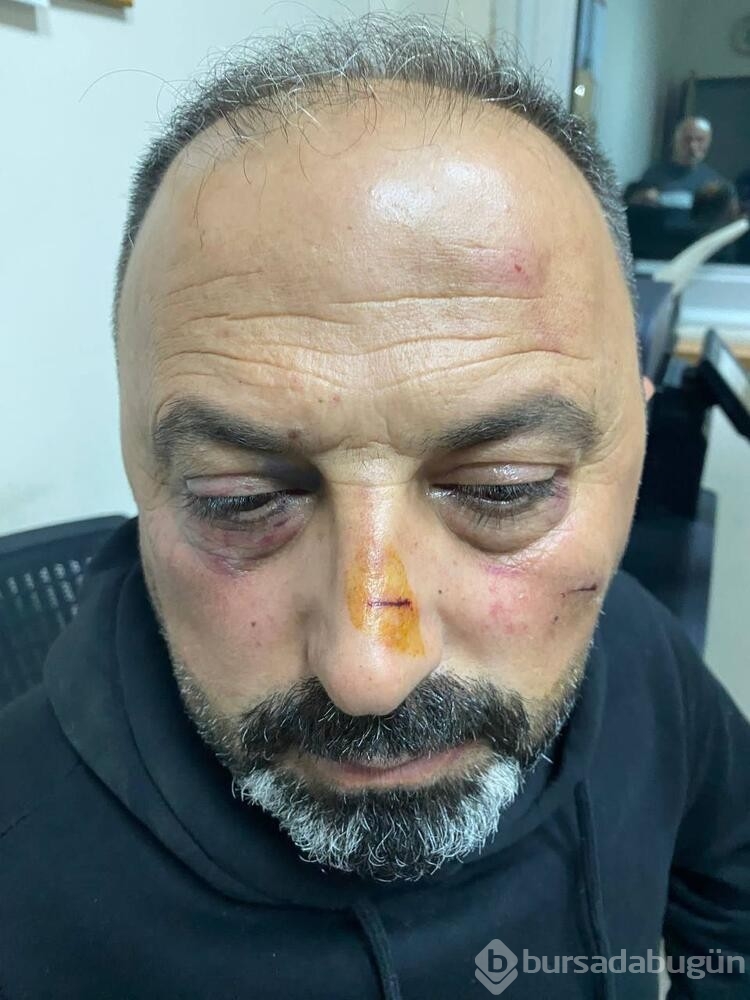 Baba ve oğula 'Ne bakıyorsun' dayağı
