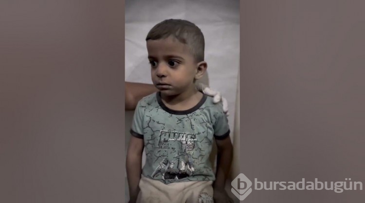Bomba saldırısında yaralanan Muhammed'den haber var