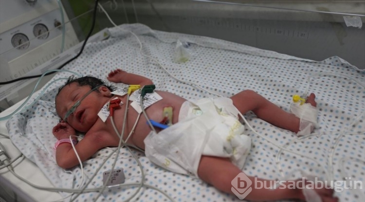 İsrail'in Gazze'ye saldırısında ölen annenin karnındaki bebek kurtarıldı
