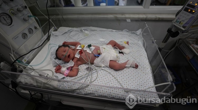İsrail'in saldırısında ölen annenin karnındaki bebek kurtarıldı
