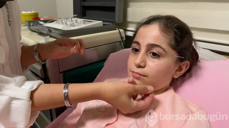 Yüz felci geçirdi çareyi akupunkturda buldu