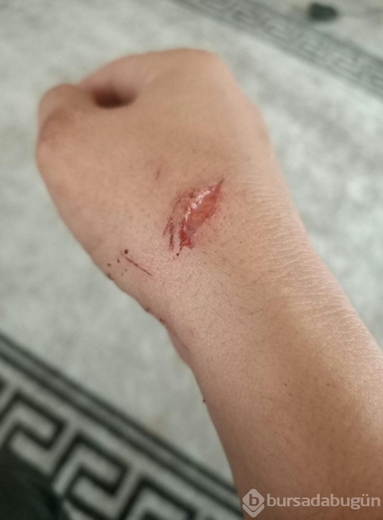 Eşini darp edip bıçaklayan şüpheli 'Haksız Tahrikle' 2 yıl 7 ay hapis cezası aldı