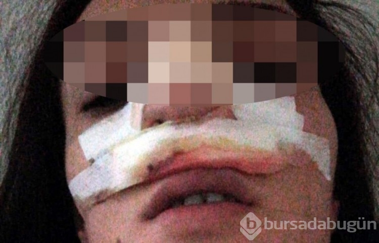 Eşini darp edip bıçaklayan şüpheli 'Haksız Tahrikle' 2 yıl 7 ay hapis cezası aldı