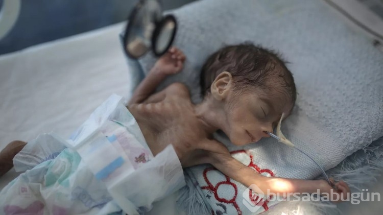  Bu yıl en az 17,6 milyon çocuk aç doğacak!