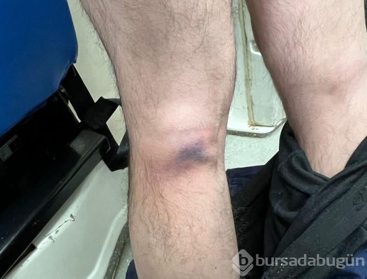 Kütahya'da sağlık çalışanlarına demir sopayla saldırı!