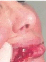 Bir anda üzerine atladı, dudağını kopardı: Stilist kadın kabusu yaşadı