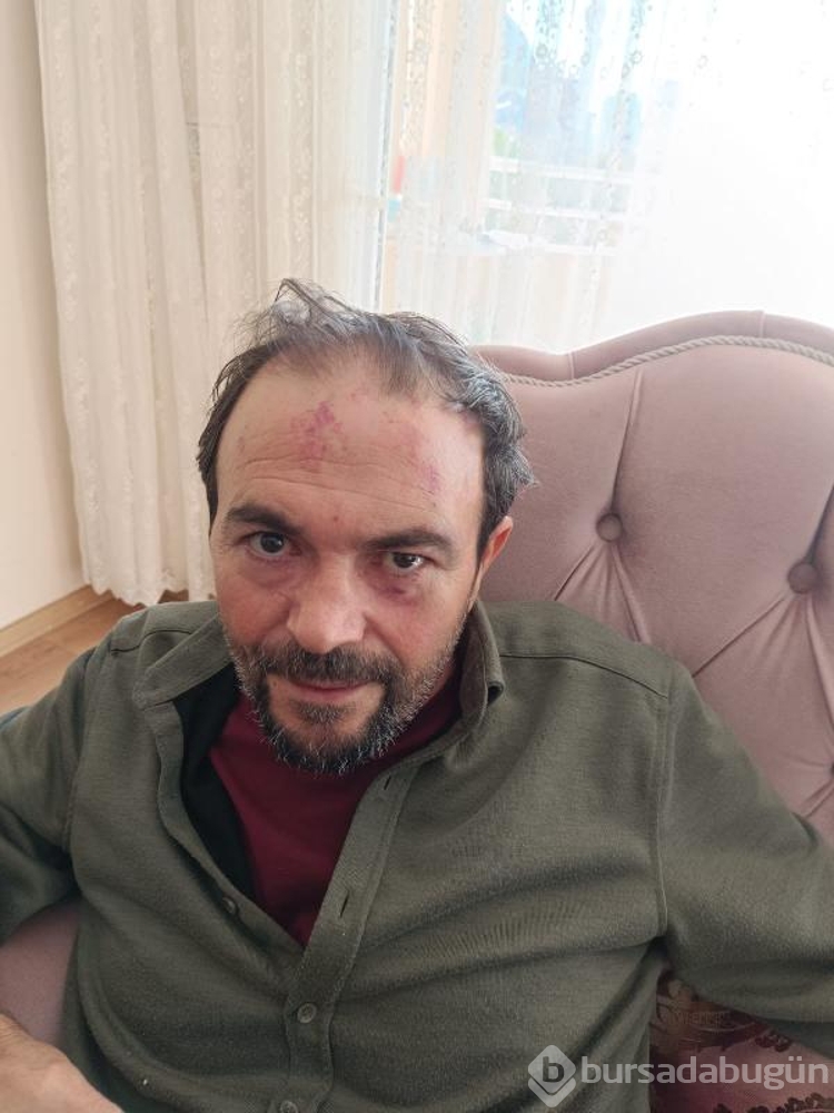 Polise kimlik göstermeyen öğretmen darbedildiği iddiasıyla şikayetçi oldu