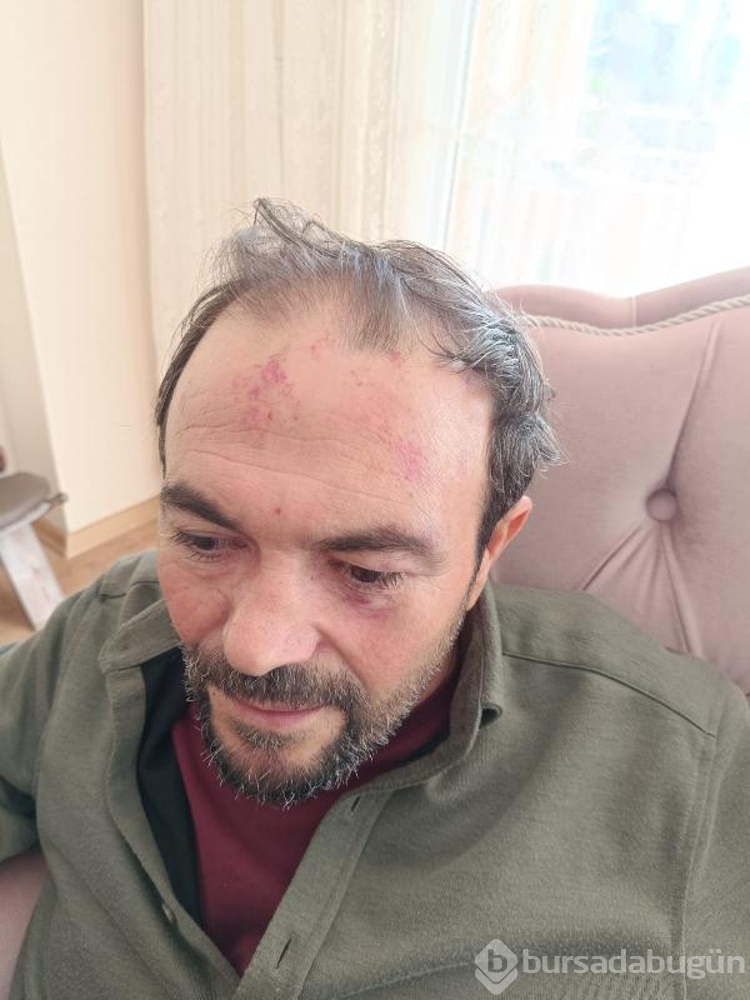 Polise kimlik göstermeyen öğretmen darbedildiği iddiasıyla şikayetçi oldu