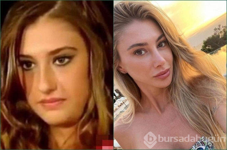 Ünlülerin yaşadıkları değişimi görünce, çok şaşıracaksınız!