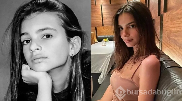 Ünlülerin şöhrete kavuşmadan önceki ve sonraki halleri!