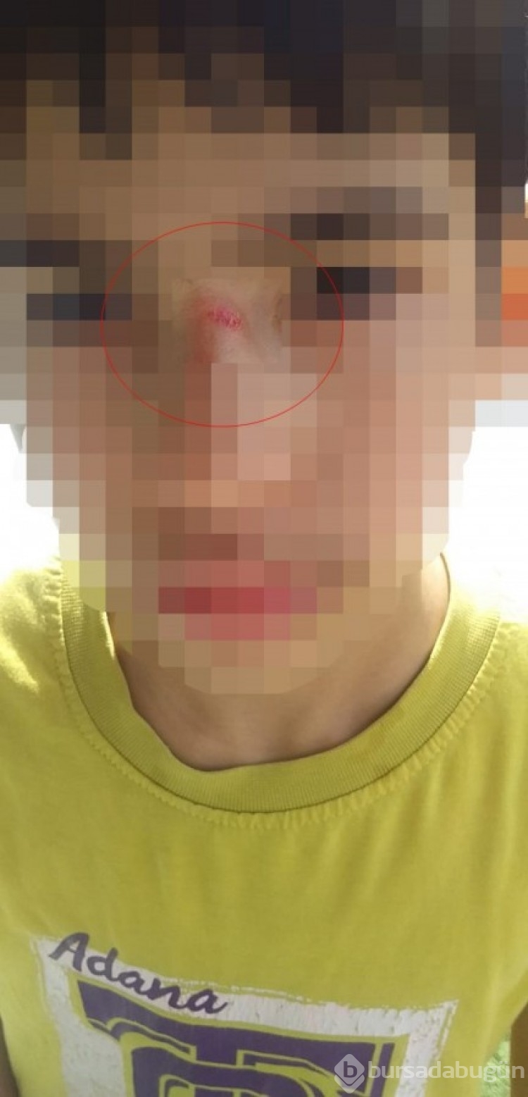 Adana'da 3. sınıf öğrenciye akran zorbalığı! Annesi şikayetçi oldu
