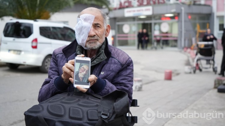 Sinop'ta yüzü eriyen adamın yardım çığlığı: Suratım mum gibi eriyor, gözüm akıyor