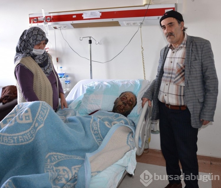 Covid sonrası yüzü çürümeye başladı, aile yardım istedi
