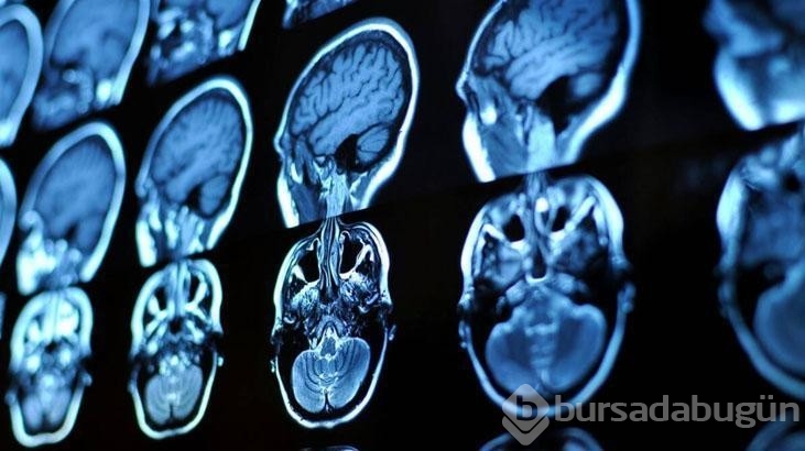 Bu kan grubuna sahip olanların ömrü daha uzun oluyormuş!