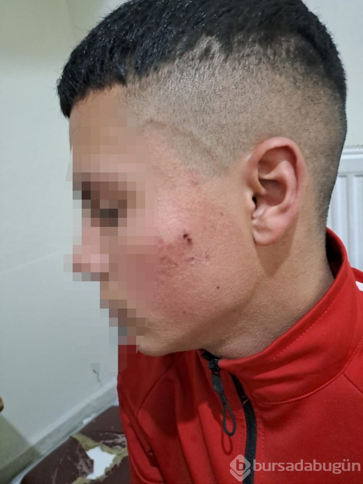 17 yaşındaki sürücüye polis dayağı iddiasına soruşturma
