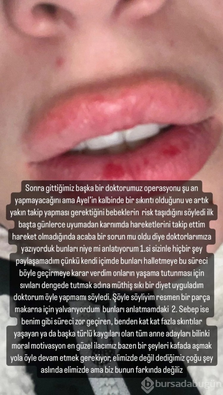 Yasemin Şefkatli zorlu hamilelik sürecini ilk kez anlattı!