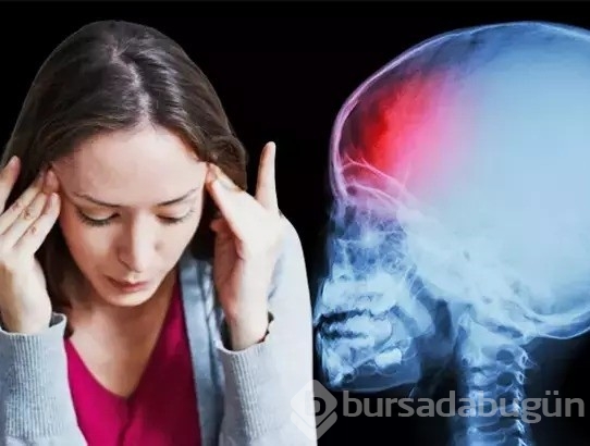 150 çeşit baş ağrısı ve çözümü tespit edildi!