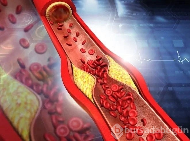 Kolesterolü damarlardan adeta temizleyen tarif!