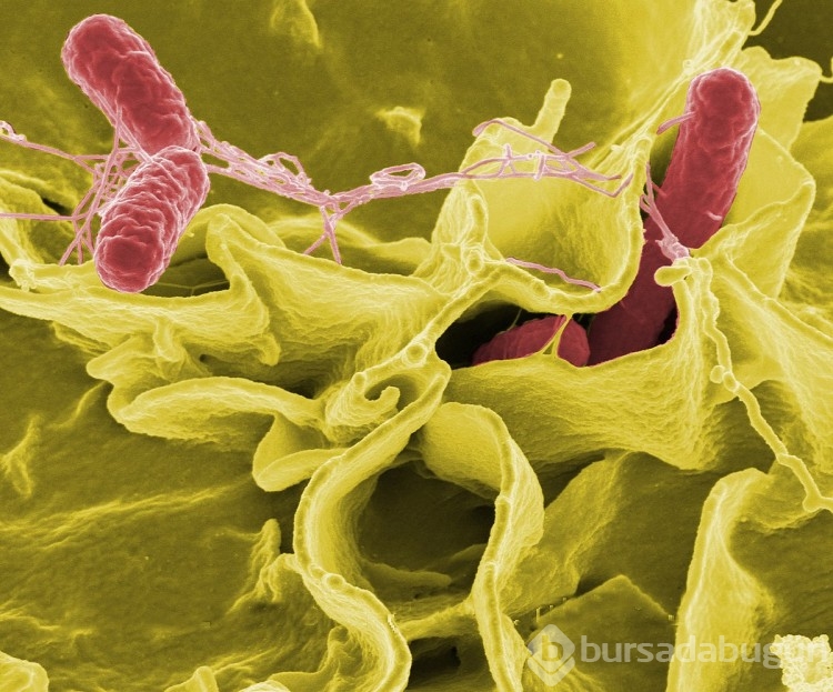 Salmonella bakterisi nedir? Salmonella bakterisi belirtileri nelerdir?