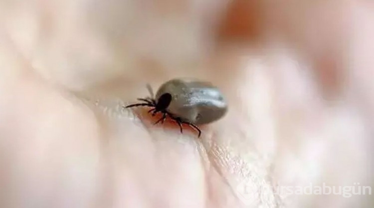 Kene kabusu başladı! Isırıldıktan sonra hemen bu 2 şeyi yapın!