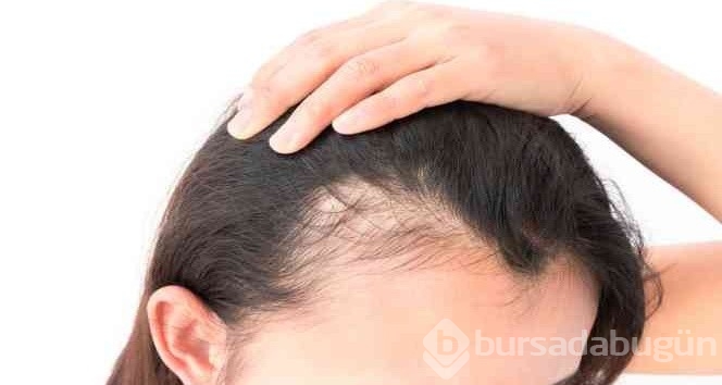 Saç dökülmesi nasıl geçer? Saç dökülmesi en hızlı nasıl durdurulur?