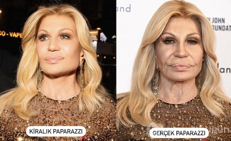 Dünyaca ünlü isimlerin estetik facialarını görünce şaşıracaksınız!