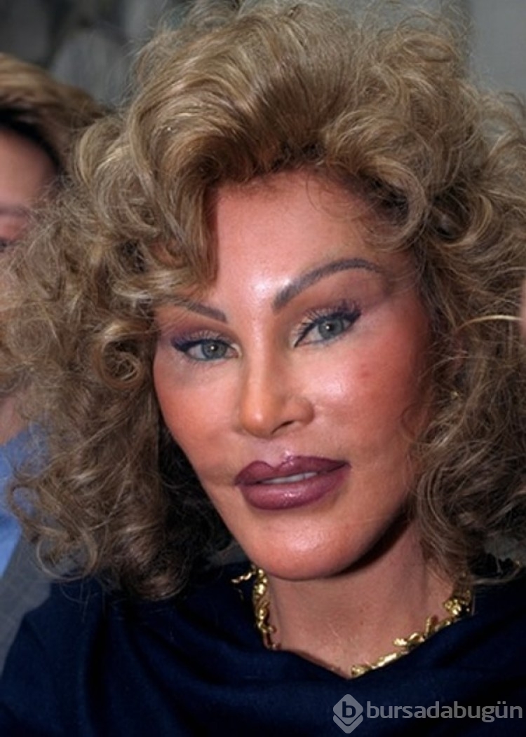 Dünyaca ünlü isimlerin estetik facialarını görünce şaşıracaksınız!