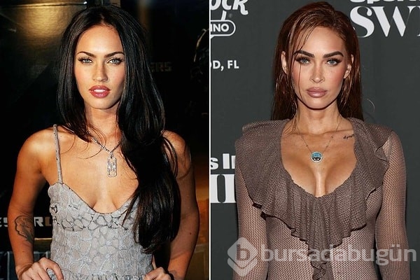 Dünyaca ünlü isimlerin estetik facialarını görünce şaşıracaksınız!