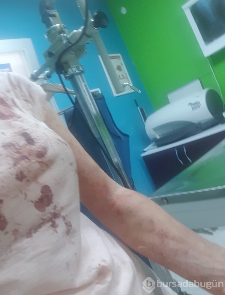Bursa'da sabah yürüyüşü sonrası canından oluyodu!