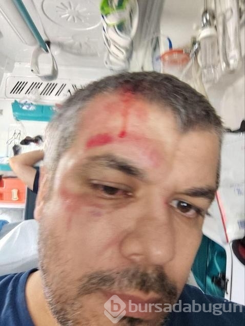 Sinyal verme kavgasının sonu kötü bitti...