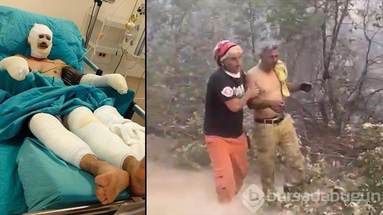 Orman yangınında ağır yaralanan adamın son halini eşi paylaştı!