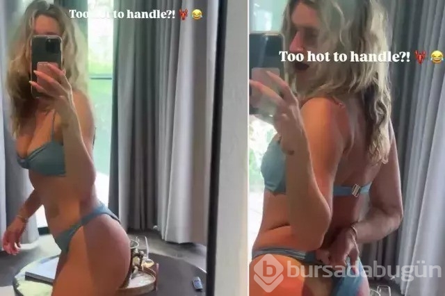 Ashley Roberts, Türkiye tatilinde güneşin bedelini esprili sözlerle anlattı
