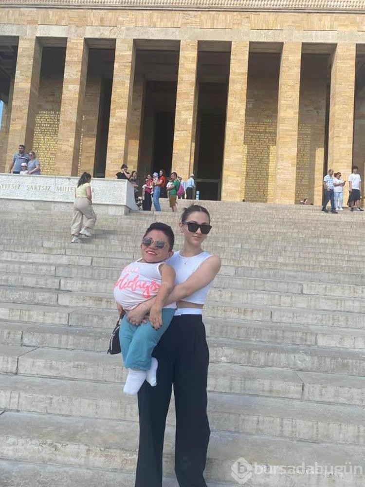 24 kilo ağırlığındaki Nurdan'ın yumurtalıklarından 3 kilo kist çıkarıldı