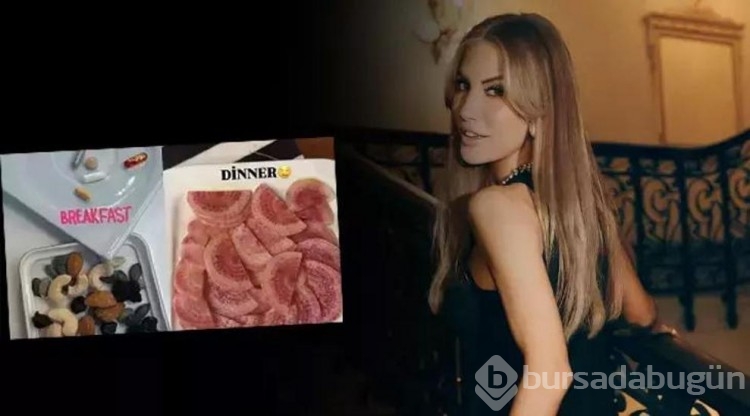 Çağla Şıkel'in yeni hobisi! bacakları mosmor oldu