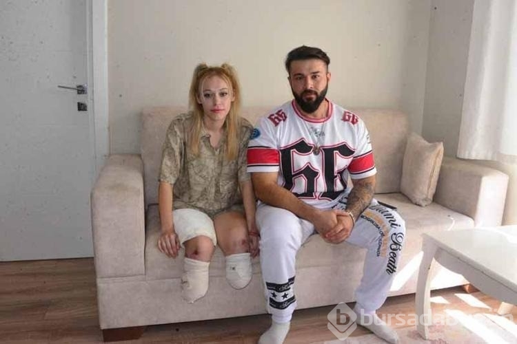 Evlilik yıl dönümünde bacaklarını kaybetti
