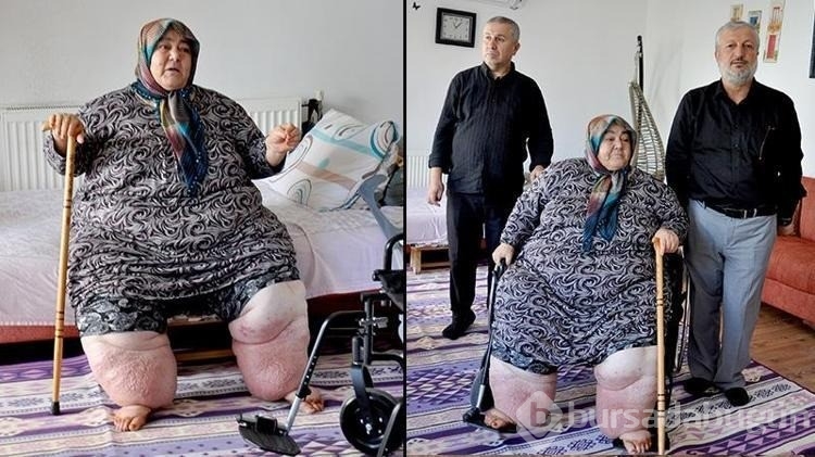 3 yıldır evden çıkamayan fil hastası kadının tekerlekli sandalye sevinci
