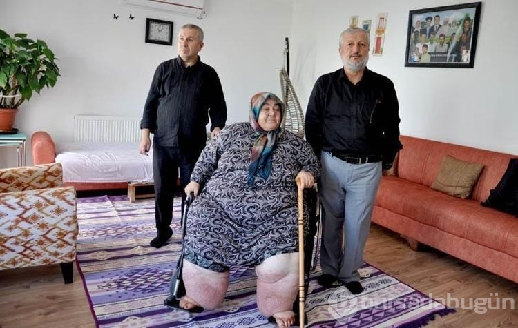 3 yıldır evden çıkamayan fil hastası kadının tekerlekli sandalye sevinci