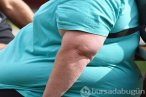 Yüzyılın salgını obezite: Türkiye Avrupa'da ...