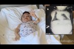 24 kilo ağırlığındaki Nurdan'ın yumurtalıkla...