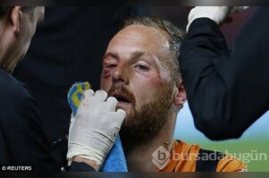 David Meyler gözünü kaybediyordu!
