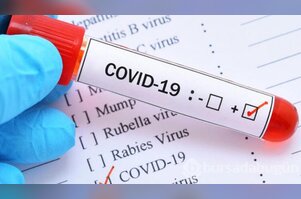 Çin'den corona için gelen ilaç Favipiravir nedir?