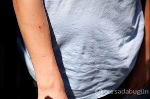 İstanbul'da 'Aedes' tehdidi