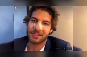 Mustafa Mert Koç burnuyla ilgili gerçeği açıkladı
