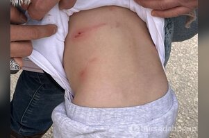 Sivas'ta tasmalı köpek dehşeti