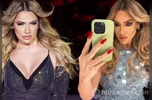 Hadise, paylaştığı gönderide yüzündeki değişimle sosyal medyada gündem oldu!