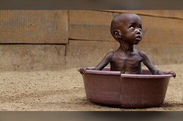 Somali dünyanın en feci felaketini yaşıyor