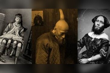 Milyonda bir görülen hastalıklar