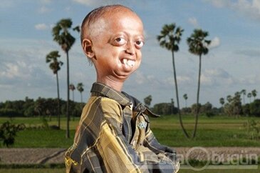 110 yaşında gibi görünen çocuk!
