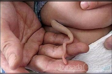 Bu hastalıkları ilk defa duyacaksınız!