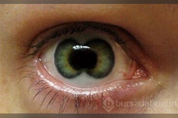 Dünyada lens çılgınlığı!